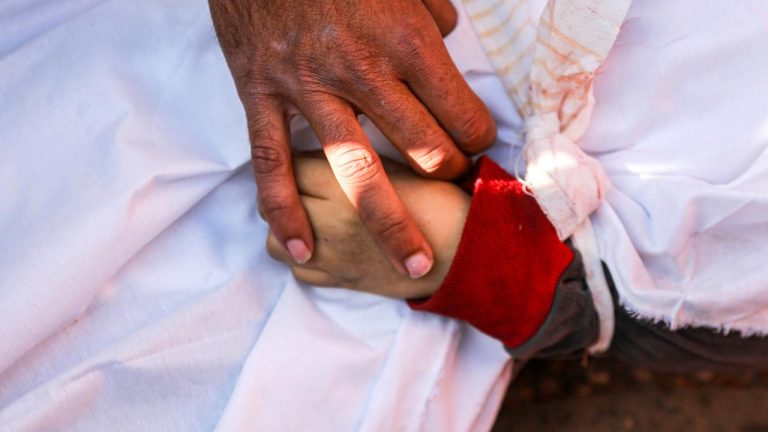 Gazze’de can kaybı 35 bin 456’ya çıktı